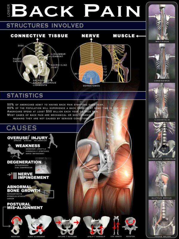 Menezes Method Back Pain Workshop - Image 2