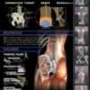Menezes Method Back Pain Workshop - Image 2