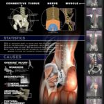 Menezes Method Back Pain Workshop - Image 2